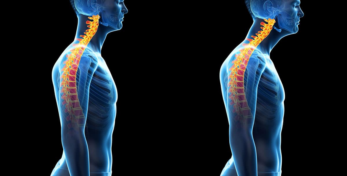 Can good posture improve your mood? An expert explains