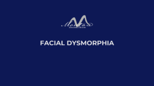 facial dysmorphia